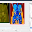 Torso scans from a CT scanner being analysed