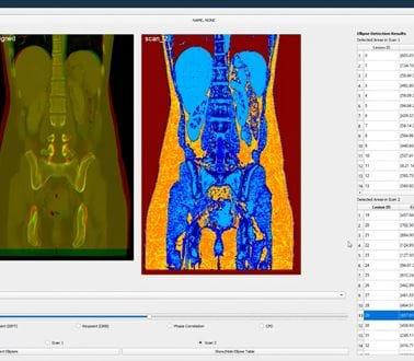 Torso scans from a CT scanner being analysed