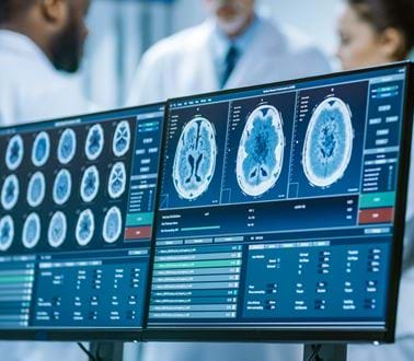 NHS medical scan data on a desktop computer